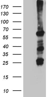 FANCC Antibody (aa1-284, clone OTI8A7)