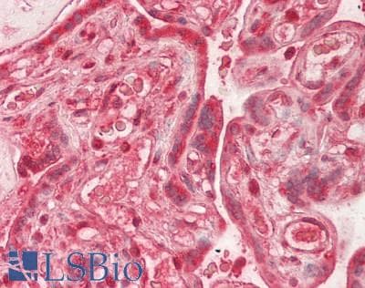 IHC-plus™ Polyclonal Rabbit anti-Human HSPA8 / HSC70 Antibody (aa618-637, IHC, WB)
