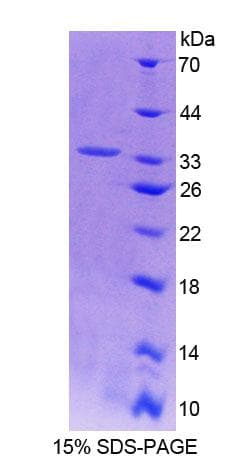 Human ACTN3 Protein (Recombinant His-T7)