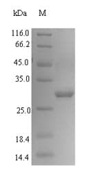 Entamoeba histolytica CALR / Calreticulin Protein (Recombinant GST, N-terminus)