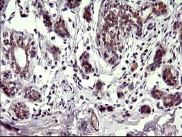 Monoclonal Mouse anti-Human CHAC1 / MGC4504 Antibody (clone OTI1E2, Carrier-free, IHC, IF, WB)