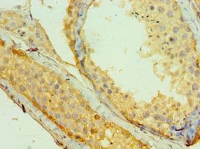 Polyclonal Rabbit anti-Human MAGEA1 / MAGE 1 Antibody (aa1-309, IHC)