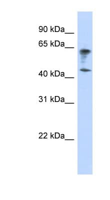 IGSF11 / VSIG3 Antibody (aa179-228)