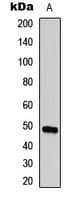 TMPRSS3 Antibody (C-Terminus)