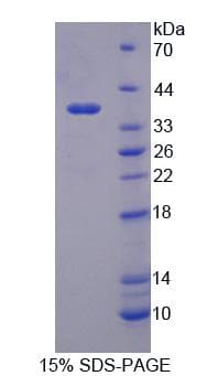 Human PSG2 Protein (Recombinant His-T7)