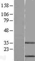 Human CSTB / Cystatin B / Stefin B Protein (Over-Expression Lysate Myc-DDK (Flag))