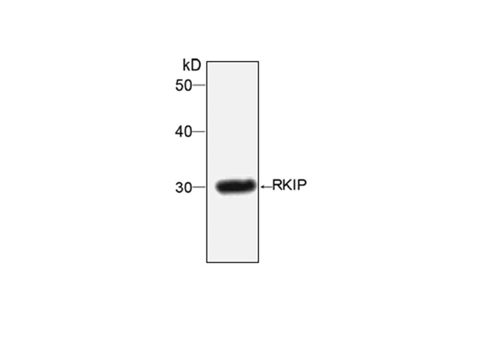 IHC-plus™ PEBP1 / RKIP Antibody