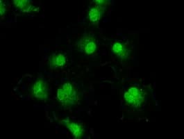 TYRO3 Antibody (clone OTI2C4)