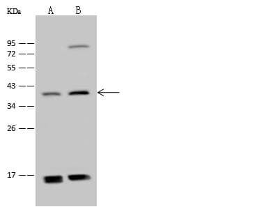 ADAT3 Antibody