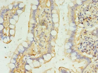 BRINP2 / FAM5B Antibody
