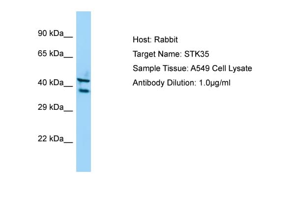 STK35 Antibody (C-Terminus)