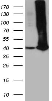 GALM / Mutarotase Antibody (clone OTI10B3)