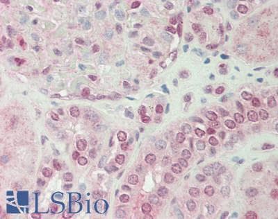 RIOK2 Antibody (aa107-156)