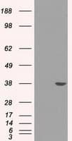 SORD / Sorbitol Dehydrogenase Antibody (clone OTI12A7)