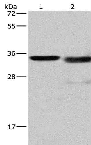 Polyclonal Rabbit anti-Human CTSL / Cathepsin L Antibody (IHC, WB)