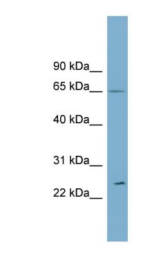 Polyclonal Rabbit anti-Human RPN2 / Ribophorin II Antibody (aa503-552, WB)