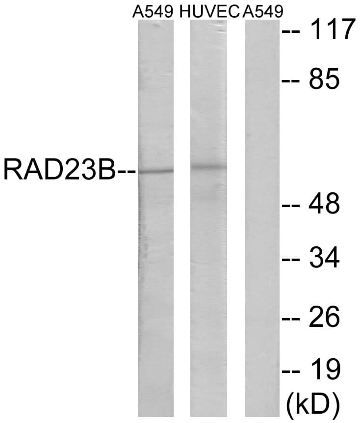 Polyclonal Rabbit anti-Human RAD23B / HR23B Antibody (aa1-50, WB)
