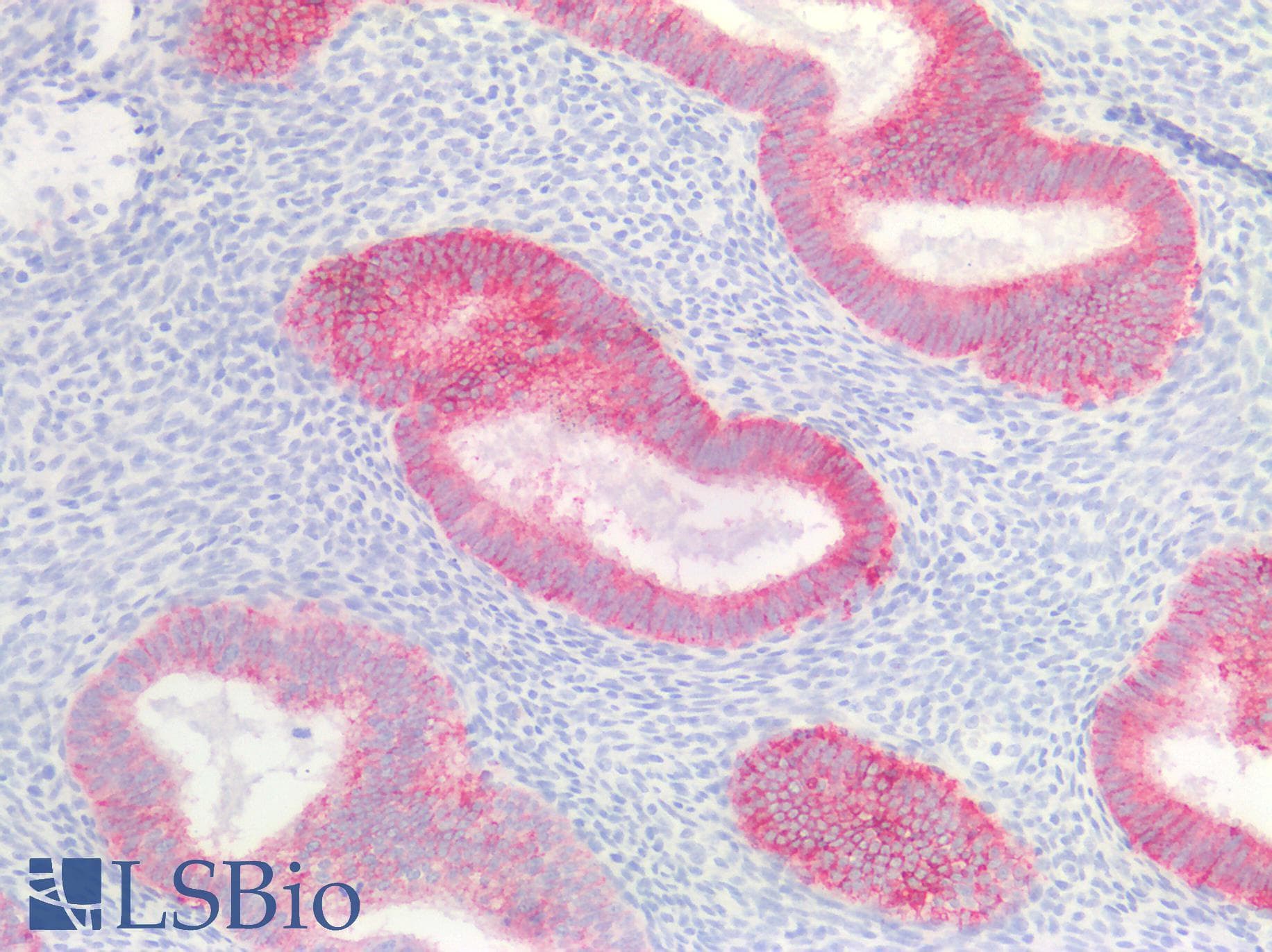 IHC-plus™ CLDN4 / Claudin 4 Antibody (C-Terminus)