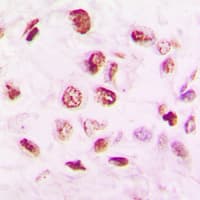 Polyclonal Rabbit anti-Human HDAC9 Antibody (C-Terminus, IHC, IF, WB)