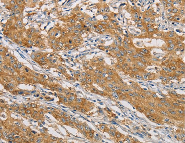 ARHGEF7 Antibody