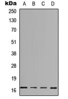 IHC-plus™ Polyclonal Rabbit anti-Human IL3 Antibody (Internal, IHC, WB)