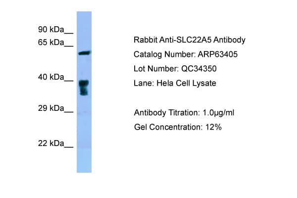 SLC22A5 / OCTN2 Antibody (C-Terminus)