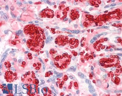 HBA1+2 / Hemoglobin Alpha Antibody (aa1-142)
