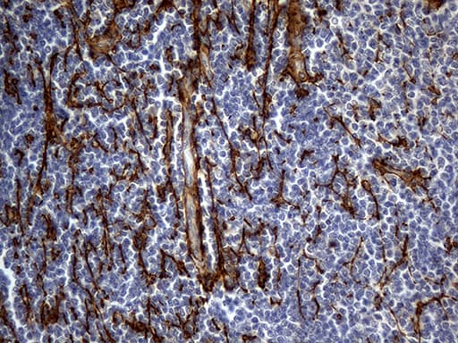 TGFBI Antibody (aa405-683, clone OTI9A11)
