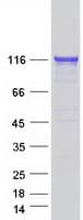 Human TXNDC11 Protein (Recombinant Myc-DDK (Flag))