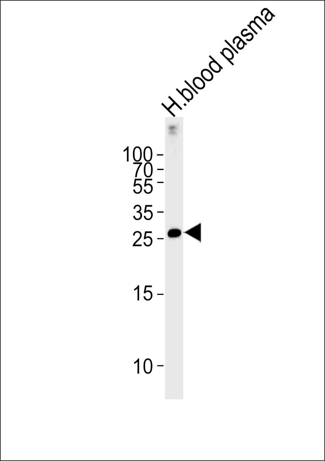 Complement C1QB Antibody (aa55-81)