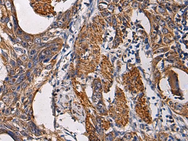 SSH3 Antibody