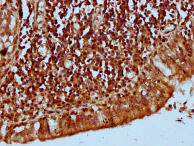 Polyclonal Rabbit anti-Human KLHL20 Antibody (IHC, IF)