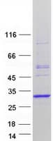 Human MAD2B / REV7 Protein (Recombinant Myc-DDK (Flag))