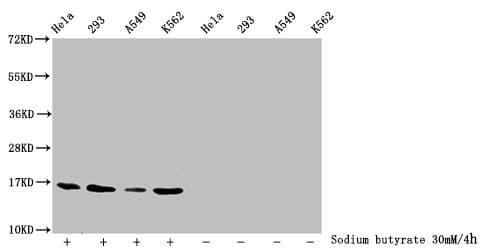 Polyclonal Rabbit anti-Human HIST1H3A Antibody (IHC, IF, WB)