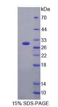 Human ARHGAP45 Protein (Recombinant His, N-Terminal)