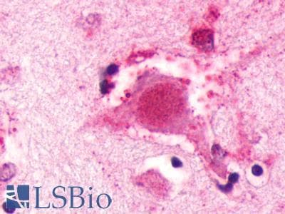 PathPlus™ Polyclonal Rabbit anti-Human GALR3 / Galanin Receptor 3 Antibody (C-Terminus, IHC)