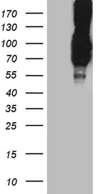 PCSK9 Antibody (aa153-692, clone OTI8E10, Carrier-free)