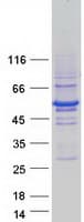 Human RNF14 / ARA54 Protein (Recombinant Myc-DDK (Flag))