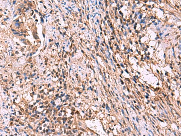 ITIH4 Antibody