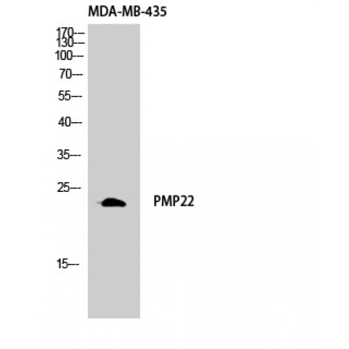 PMP22 Antibody (80-160 aa, C-terminal)