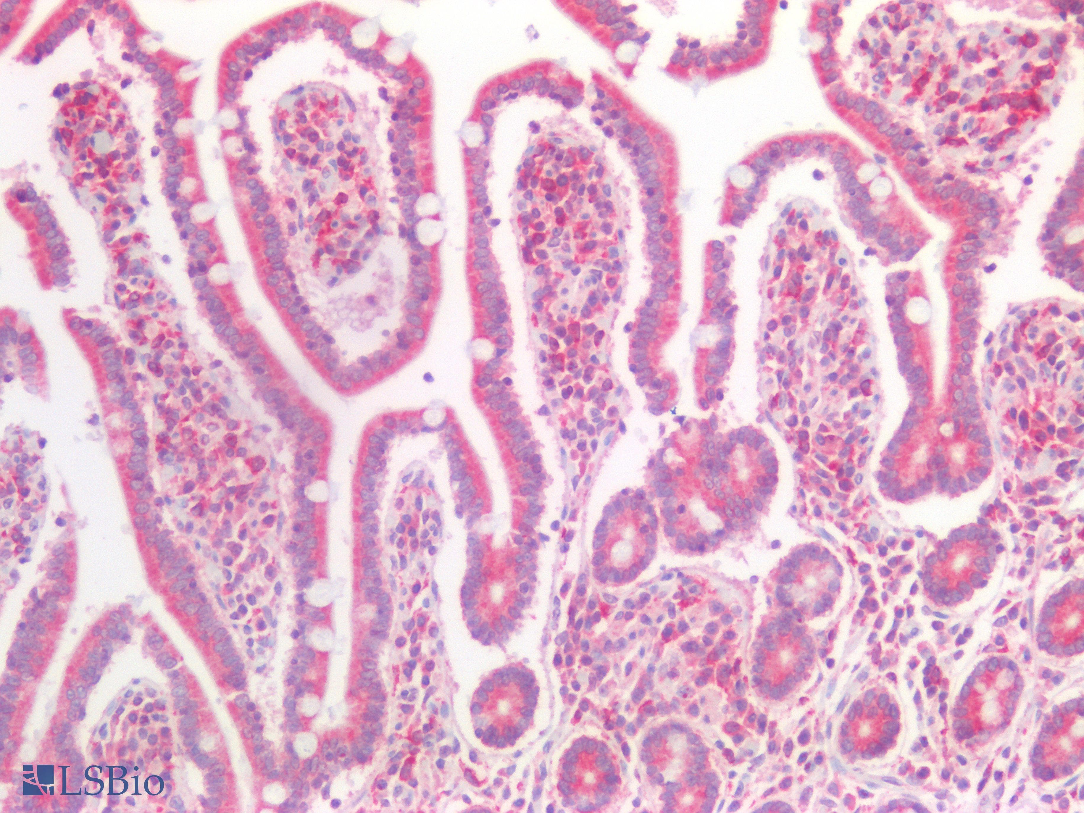 PathPlus™ TNRC5 / CNPY3 Antibody