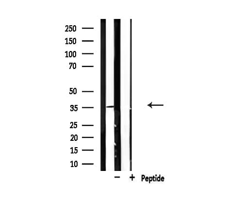 CDKL4 Antibody