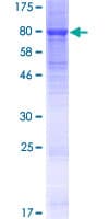 Human KLHL23 Protein (Recombinant GST)