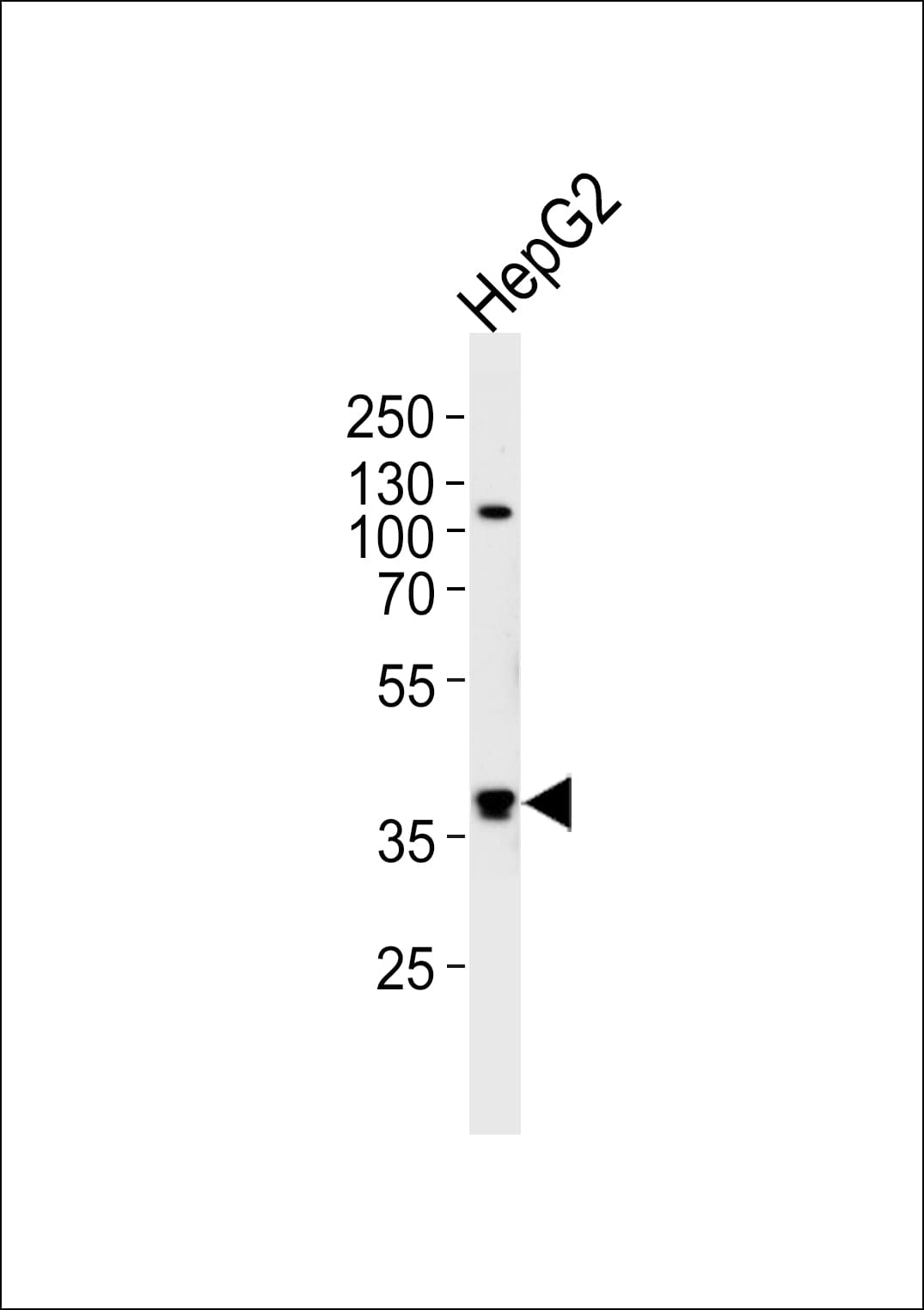 Polyclonal Rabbit anti-Human FGL1 / Hepassocin Antibody (aa218-247, IHC, WB)