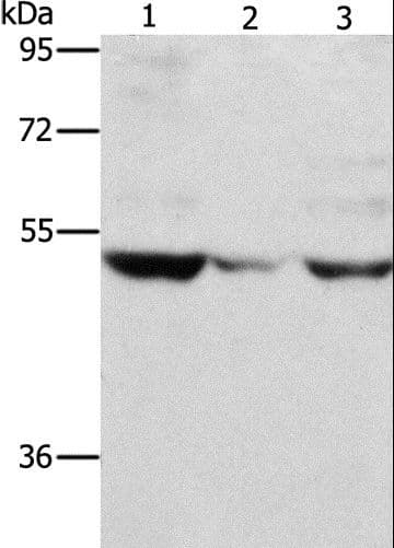 MMP1 Antibody