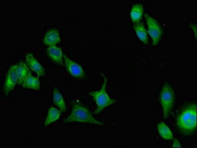 AOC3 / VAP-1 Antibody