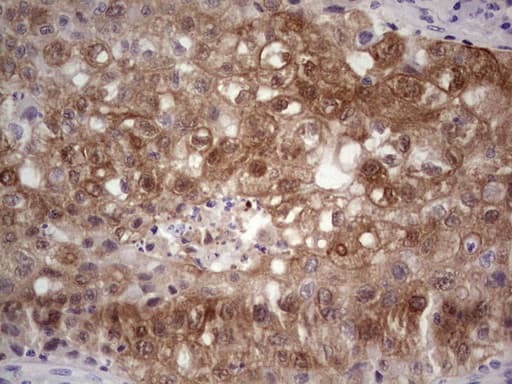 S100A6 / Calcyclin Antibody (clone OTI5A10)