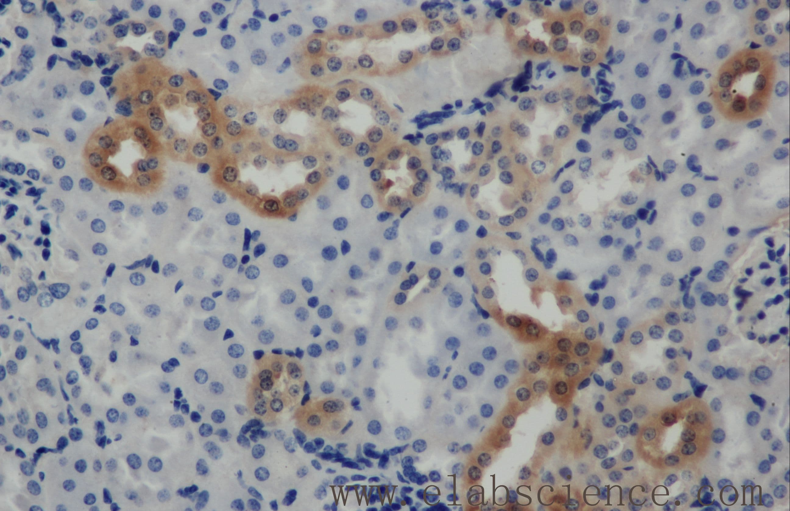 Polyclonal Rabbit anti-Human ARF6 Antibody (IHC, WB)