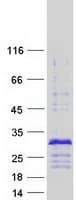 Human CRIP2 Protein (Recombinant Myc-DDK (Flag))
