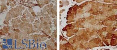 SOD2 / Mn SOD Antibody (APC)